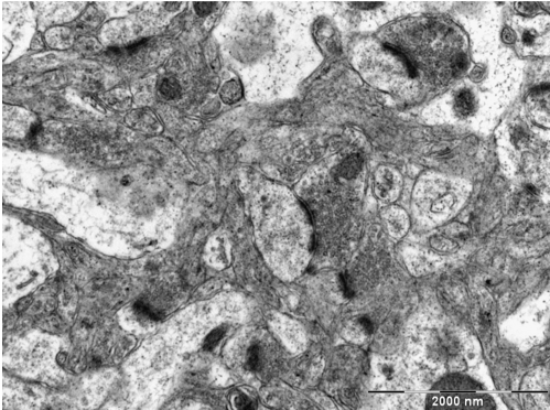 Ultrastructure of synapses in the mouse brain as seen by TEM