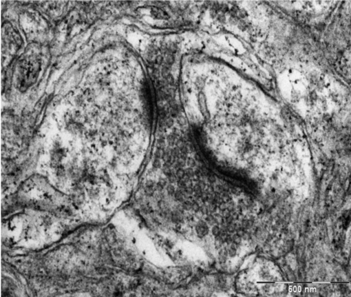 TEM image showing synaptic vesicles and post-synaptic density